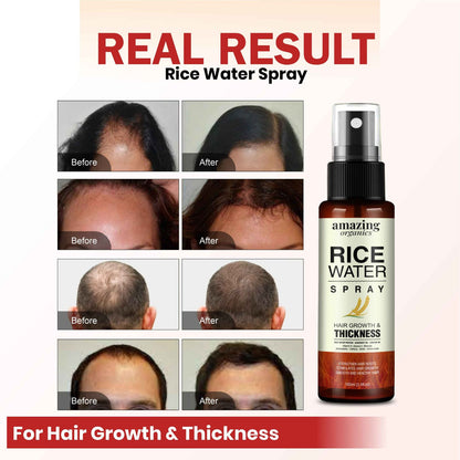 Rice Water Spray for Hair Growth