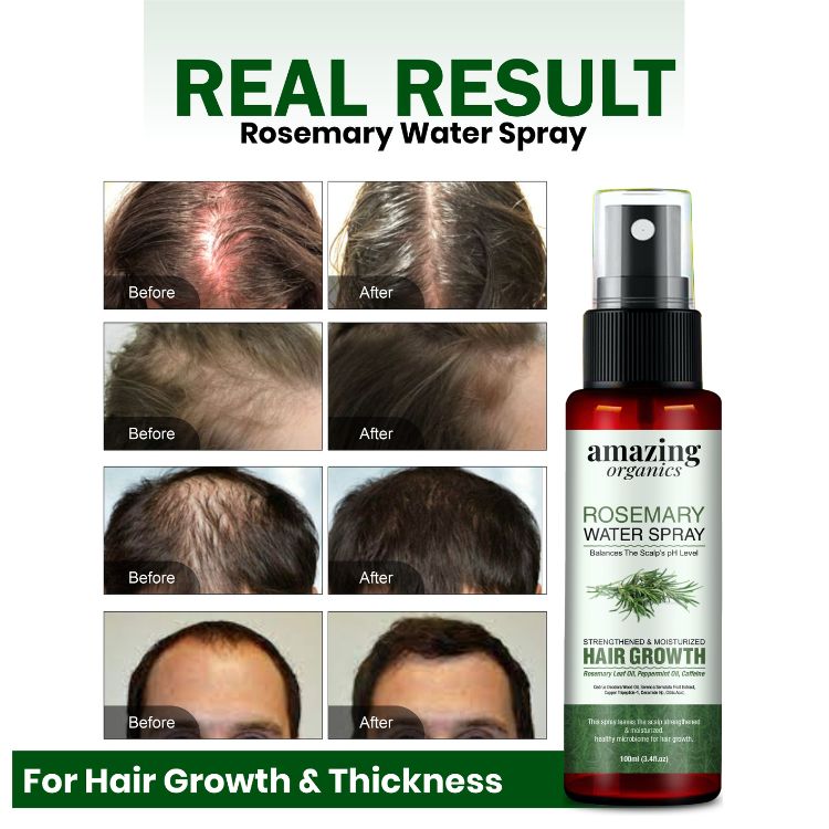 Rosemary Water Spray For Hair Growth Spray - 100 ml